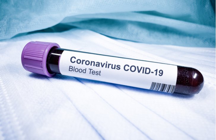 Jak si udržet finanční plán: koronavirus a nákup levných akcií